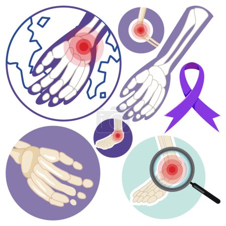 Illustration for Set of Arthritis sign illustration - Royalty Free Image