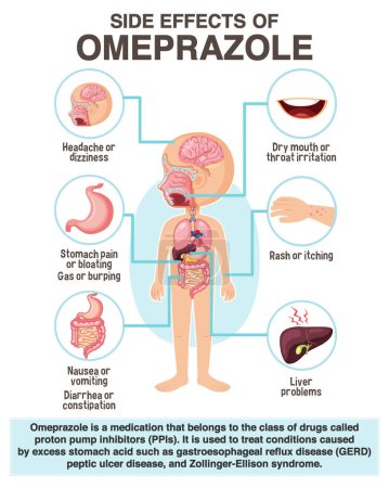 Illustration for Human anatomy diagram cartoon style of Omeprazole side effects illustration - Royalty Free Image