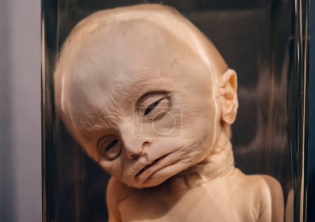 Foto de Muestra de feto humano con anomalías anatómicas en frasco de formaldehído en gabinete de curiosidades de cerca. - Imagen libre de derechos