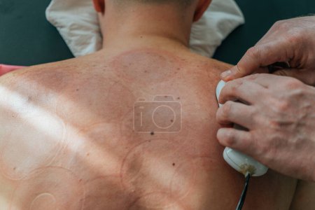 Téléchargez les photos : Vue du dessus du thérapeute professionnel fournissant le massage profond de tissu avec le masseur portatif au dos nu de patient - en image libre de droit