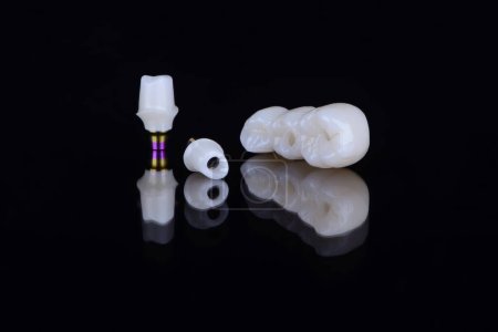 3 piezas de restauración en implantes dentales consisten en pilares de titanio, pilares de circonio individuales y puente dental de circonia, implante dental de prótesis retenida con tornillo.