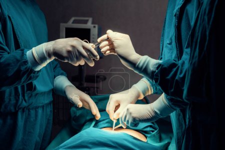 Foto de Imagen del equipo quirúrgico realiza operación quirúrgica, enfermera reparte tijeras estériles al cirujano como apoyo y cooperativo en concepto de sala de operaciones. - Imagen libre de derechos